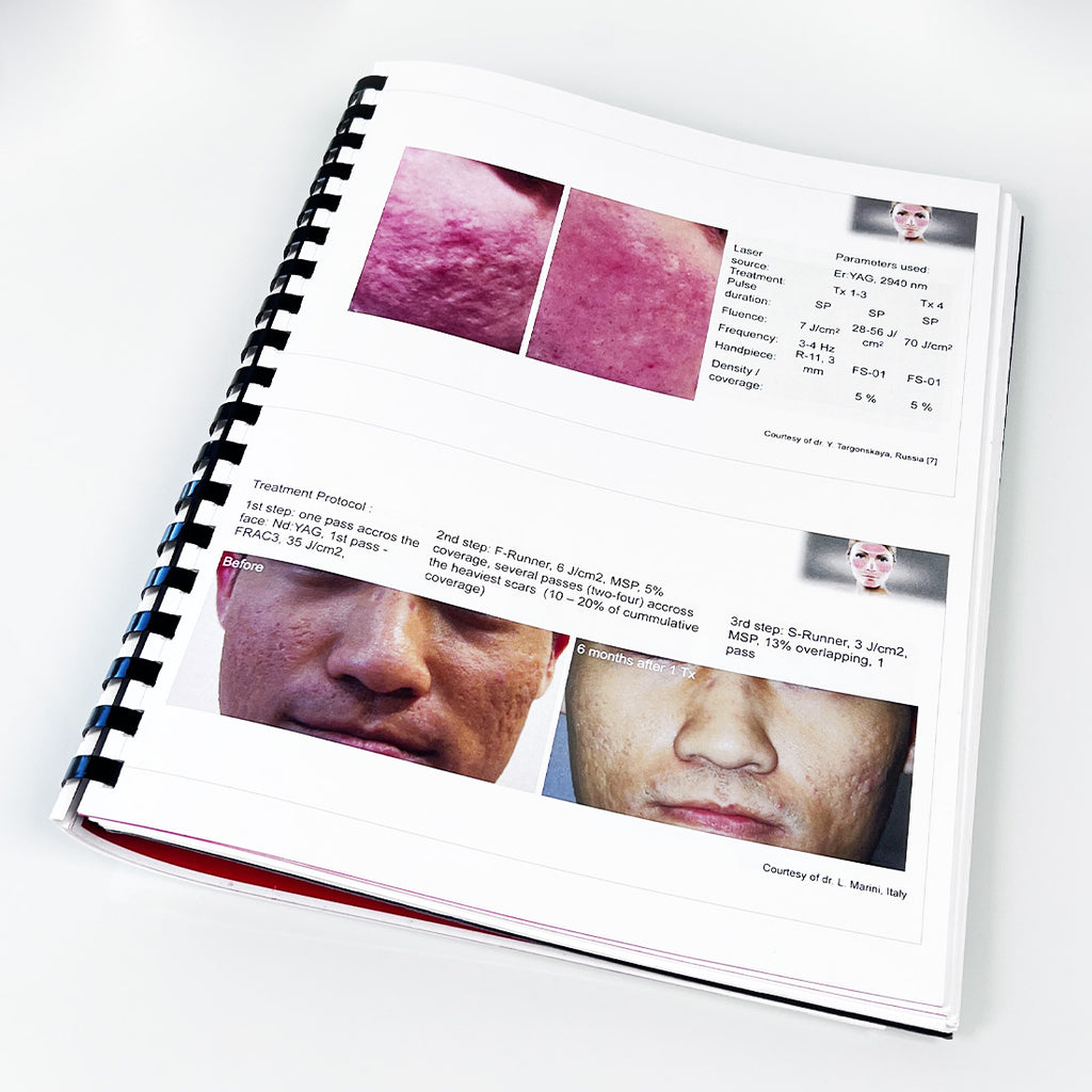 Fotona SP Dynamis Laser Aesthetic Training Operator Manual Guide Parameters