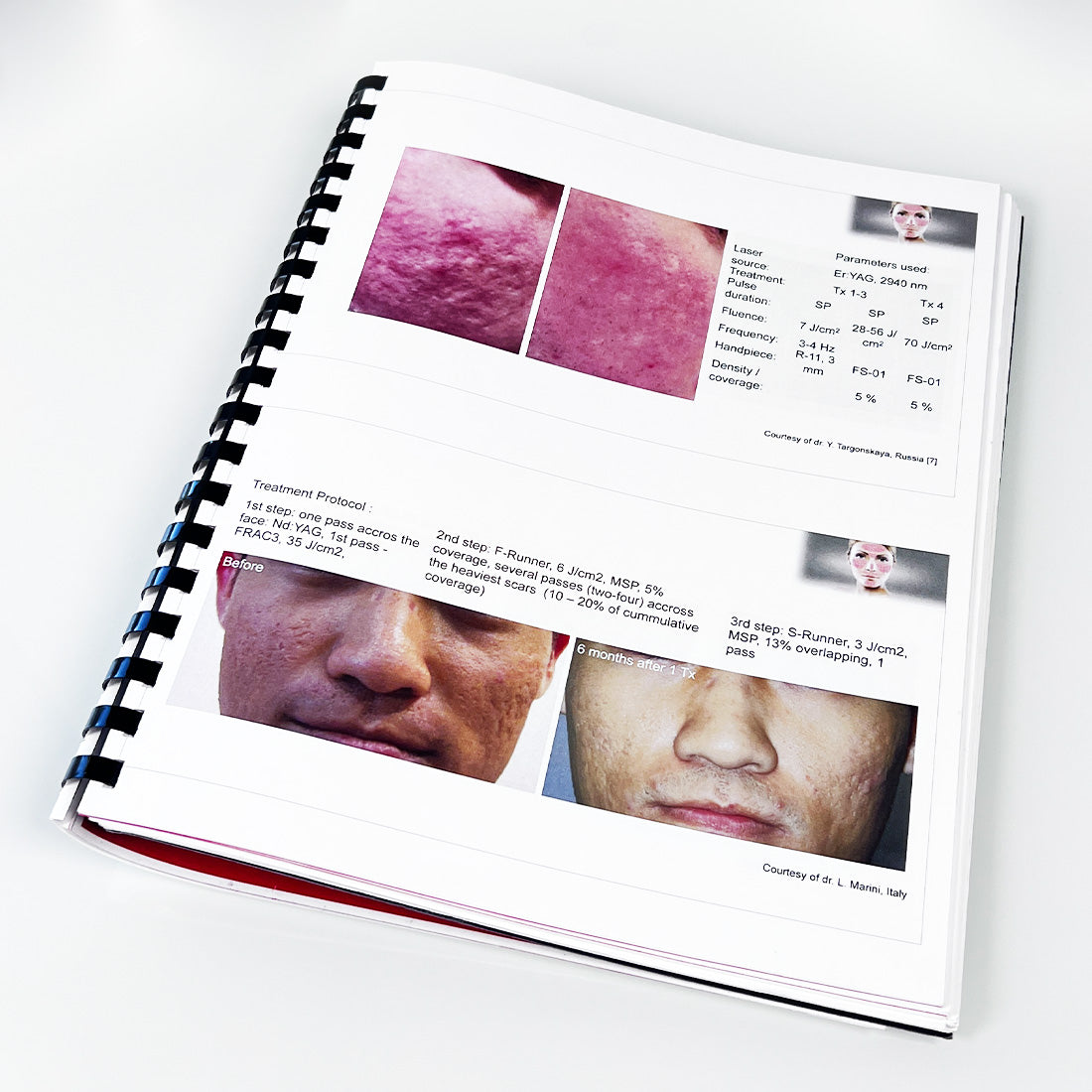 Fotona SP Dynamis Laser Aesthetic Training Operator Manual Guide Parameters