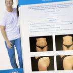 BTL Aesthetics Multi-System UnBound Patient Pre & Post Procedure Photo Data Book