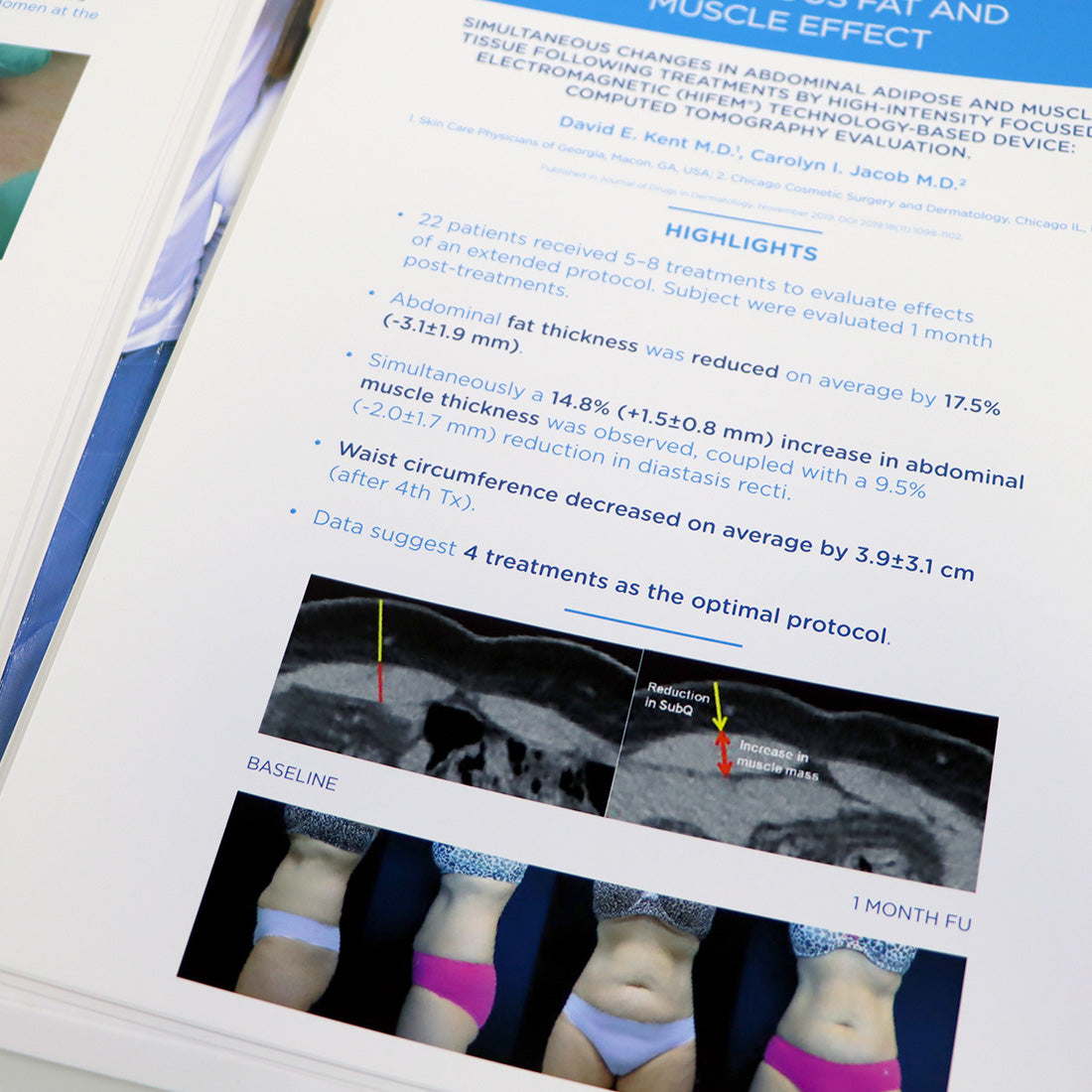 BTL Aesthetics Multi-System UnBound Patient Pre & Post Procedure Photo Data Book