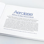 Aerolase Neo Laser Treatment Patient Before After Photos Book Office Marketing