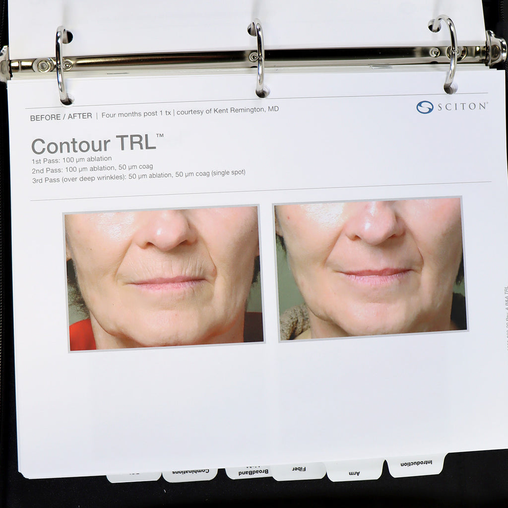 Sciton Seminar Marketing Power Point and Product Description Binder