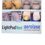 AeroLase LightPod Neo Office Marketing Cloth Banner 31.5in x 82in No Stand As-Is