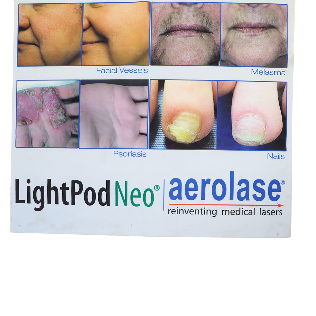 AeroLase LightPod Neo Office Marketing Cloth Banner 31.5in x 82in No Stand As-Is