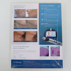 Lutronic Genius RF Marketing Info Sheet PRD-SS-00001-LutronicGenius-v05 25-Pack
