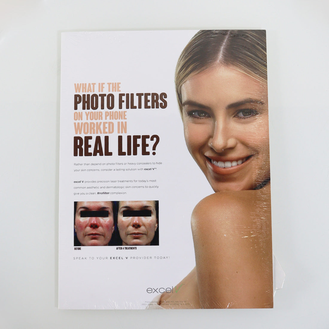 Cutera ExcelV Photo Filters in Real Life Marketing Sign 9x12in Display AP1146