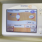 2008 Cynosure Smartlipo MPX 1064 1320 Nd YAG Laser BodySculpt Dual Wavelength