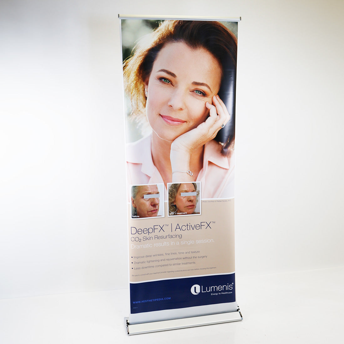 Lumenis DeepFX | ActiveFX CO2 Skin Resurfacing Office Market Banner 34in x 82in