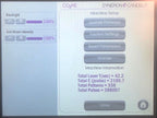 2019 Syneron Candela CO2RE Laser External Surgical Workstation System