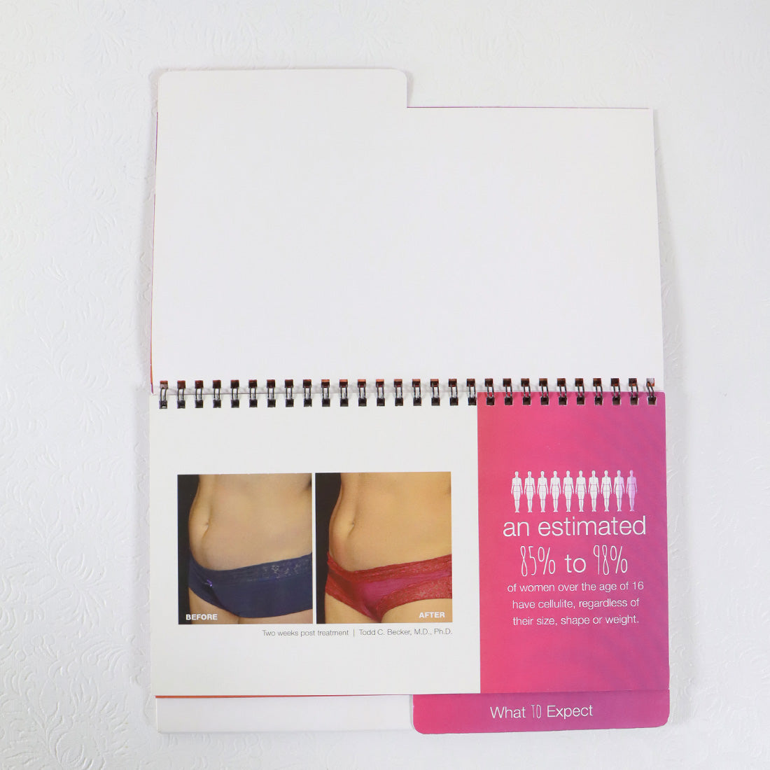 Syneron Candela VelaShape III Office Consultation Flipbook PB84402EN-NA 2014