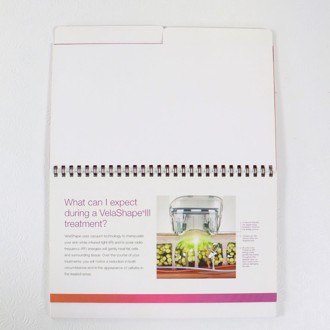 Syneron Candela VelaShape III Office Consultation Flipbook PB84402EN-NA 2014