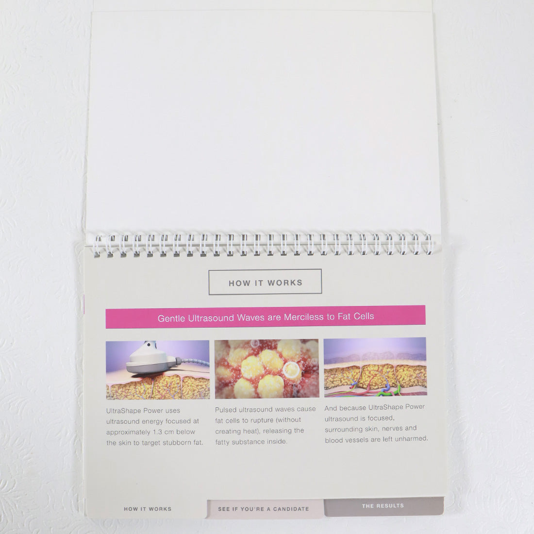 Syneron Candela UltraShape Power Office Consultation Flipbook PB91891EN-NA 2016