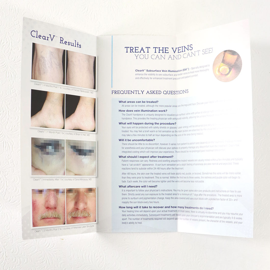 Sciton ClearV Looking Show Off Legs Office Marketing Brochure Spider Facial x50
