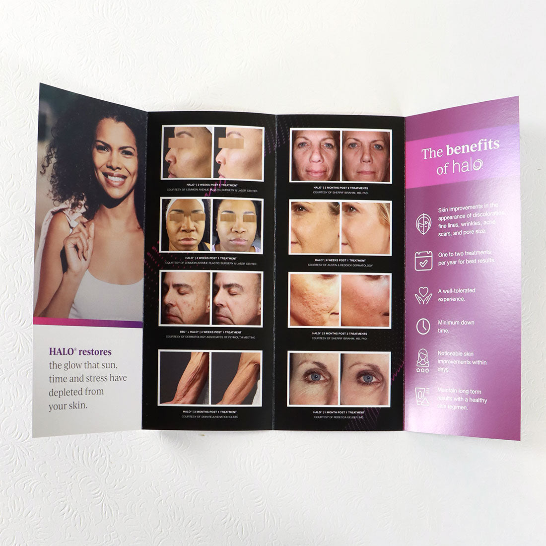 Sciton Halo Fractional Skin Resurfacing Laser Patient Office Marketing Brochures