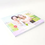Juvederm Voluma XC Facial Wrinkles Office Patient Marketing Information Book