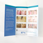 Sciton BBL Broadband Light Beautiful Skin Power Office Patient Brochure x15 Pcs