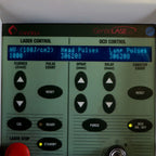 1999 Candela GentleLASE Plus 755nm Alexandrite Laser Aesthetic System Alex HR