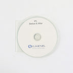 Lumenis 'IPL Before & After' Office Marketing CD Consultation Material