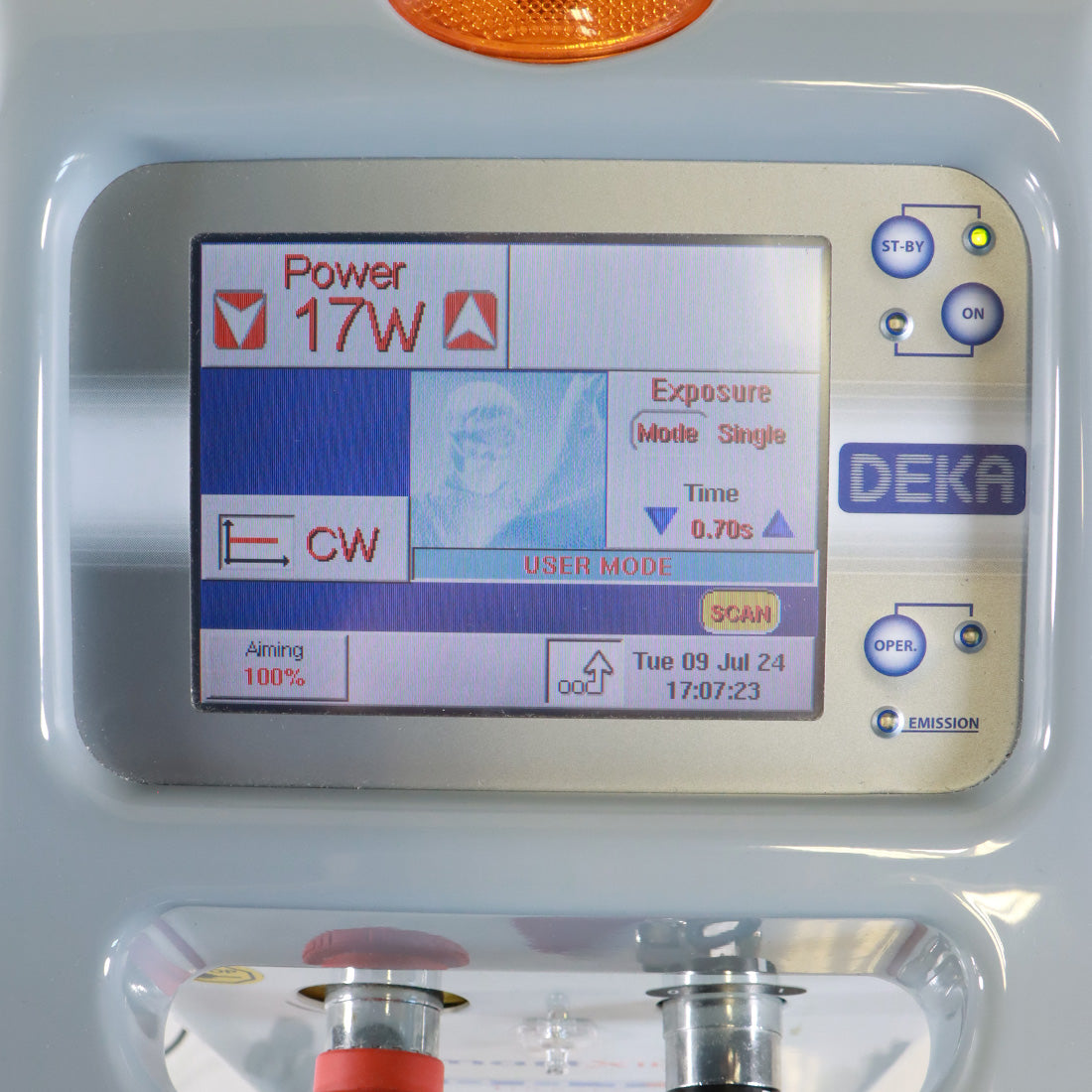 2012 DEKA Smartxide DOT CO2 Laser M079R1 HiScan Scanner Skin Resurface Rejuvenation