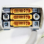 2013 Cutera Xeo Nd:Yag 1064 Laser System with LimeLight Handpiece Acne Scars