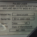 2006 Candela GentleLase Alexandrite Laser Hair Removal System