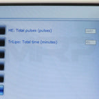 2022 Lumenis Pollogen Legend Pro System Screen