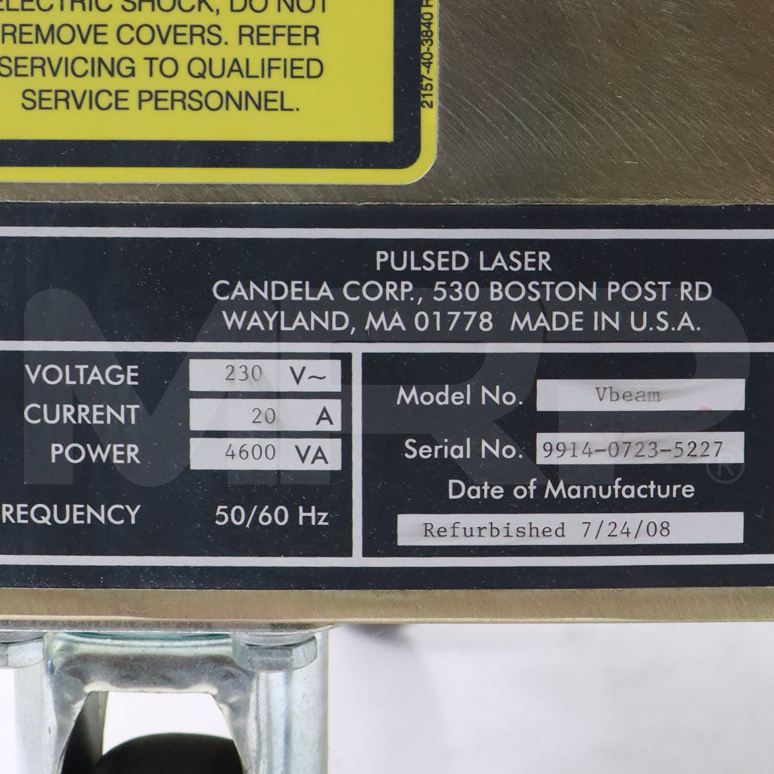 2008 Candela Vbeam Classic System Serial