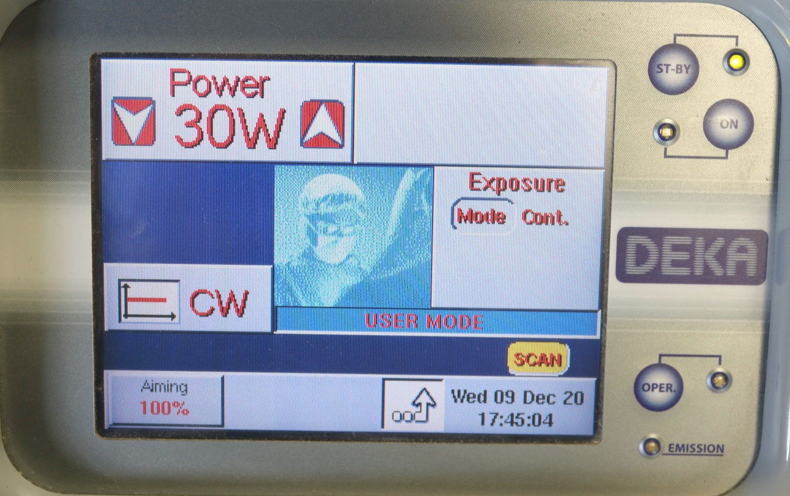 2008 Deka SmartXide CO2 Resurfacing Laser w/ Newly Regassed CO2 Tube Installed