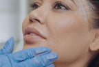 Cosmetic Injctables: Facial Balance and Harmony