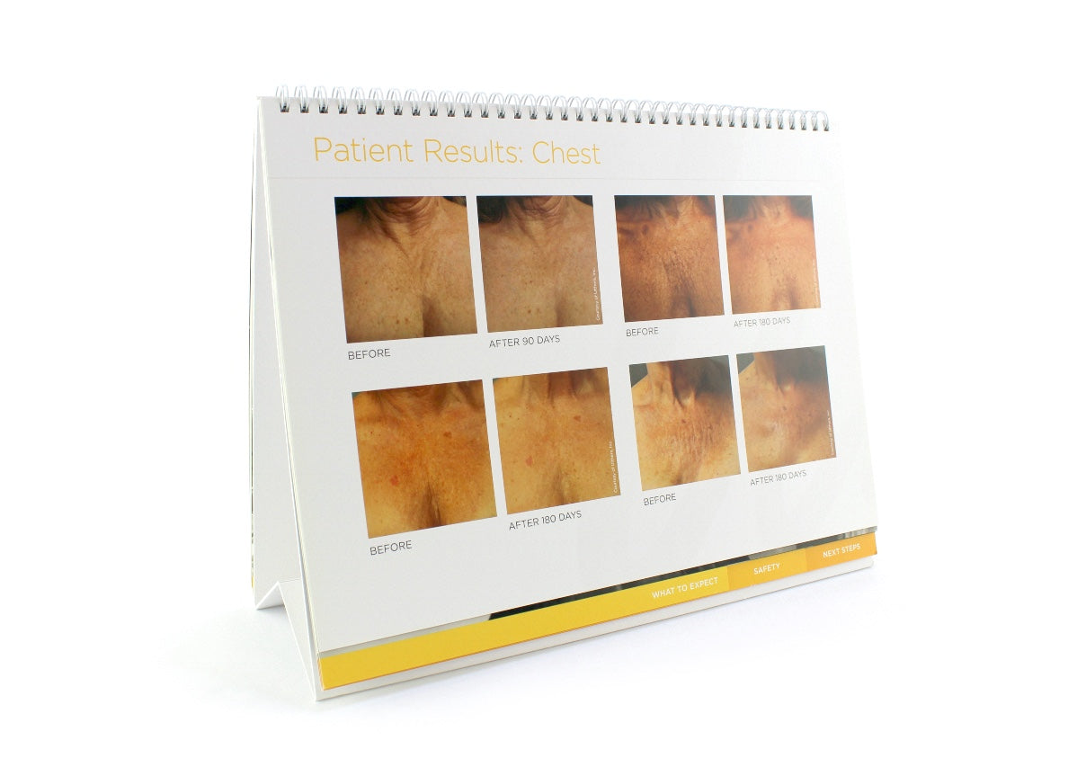 Ultherapy Consultation Educational Patient Literature / Let's Talk About a Lift
