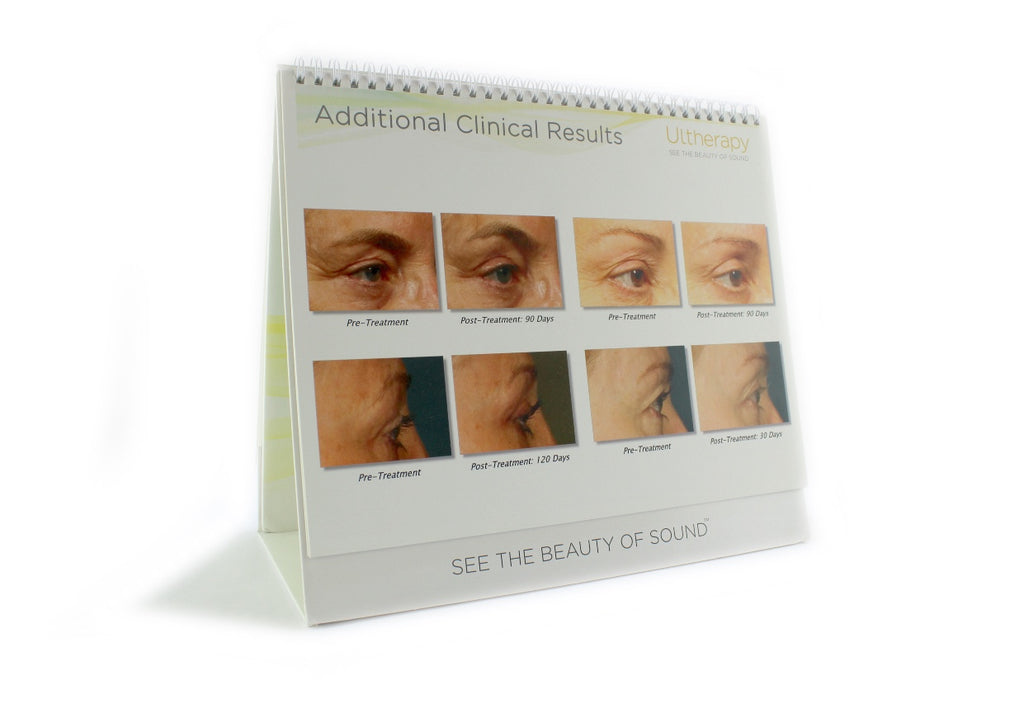 Ulthera Ultherapy Desktop Patient Consultation Double Sided Presentation Guide