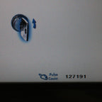 2010 Palomar Starlux 500 Lux 2940 Erbium Fractional Laser Handpiece
