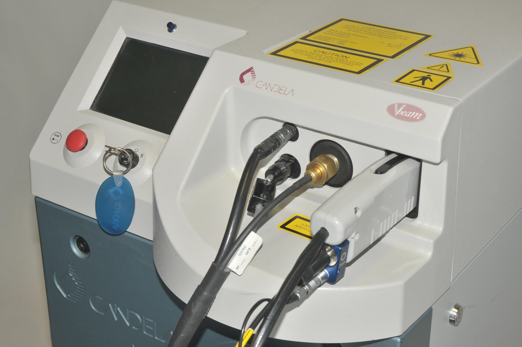 2001 Candela V-Beam PDL Pulsed Dye Laser Pulse VBeam Lesions Vascular Wrinkles