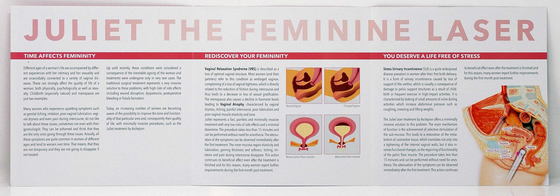 Zarin Asclepion JULIET Feminine Wellness Laser Office Marketing Brochure 50-Pack