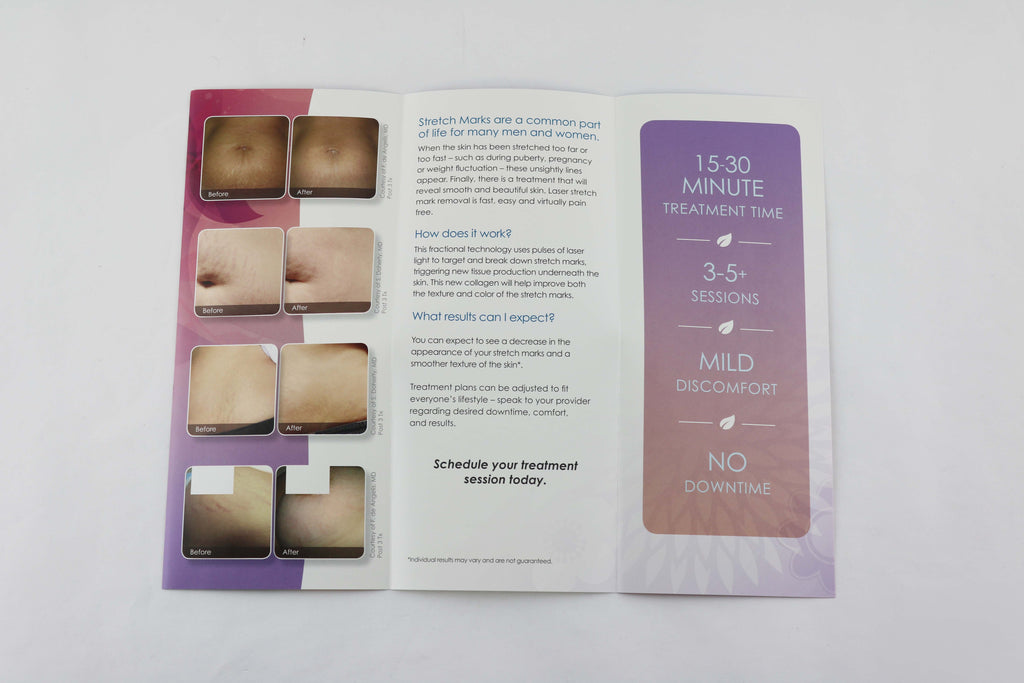 Cynosure ICON Smooth Skin Laser Stretch Mark Removal Patient Brochures 83pk