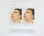Ulthera System Instructions for Use Technical Information Manual Marking Stencil