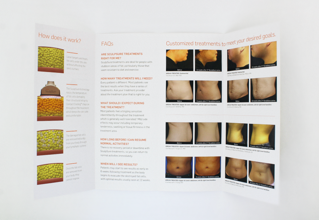 Cynosure SculpSure Permanent Fat Reduction Be Strong. Sexy. Confident Brochure