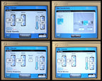 Sciton Profile BBLs Laser Broad Band Light Pigment Hair Removal Vascular Loaded