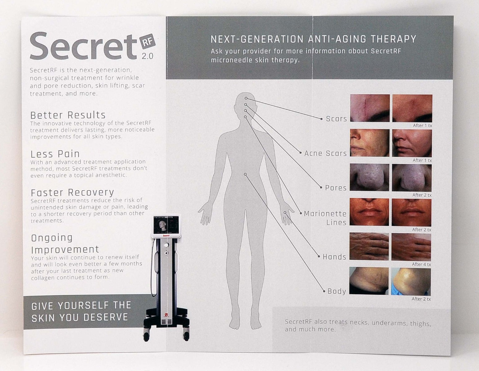 Zarin Patient Information Brochure Tri-Fold For SecretRF Per Pack Of 50 Marketing