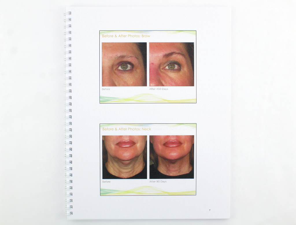 Ulthera Ultherapy Turn Back the Signs of Aging Customer Training 2015 1003213TRN