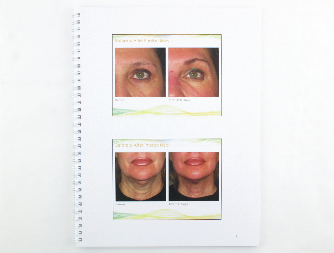 Ulthera Ultherapy Turn Back the Signs of Aging Customer Training 2015 1003213TRN
