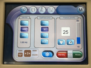 Lumenis LightSheer Duet Diode 810 Hair Removal Laser Light Sheer ET & HS 2009