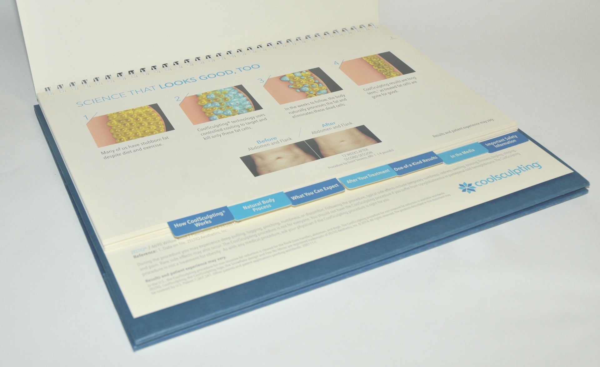 Zeltiq CoolSculpting FEAR NO MIRROR Consultation Guide Before After Photo Lobby