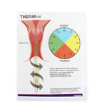 Thermiva Vaginal zones and visual demonstration of the electrodes