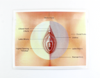 Thermiva Vaginal zones and visual demonstration of the electrodes