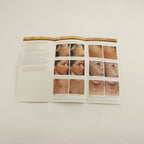 2011 Solta Fraxel Restore Dual 1550nm Skin Resurfacing Patient Brochures 33pk