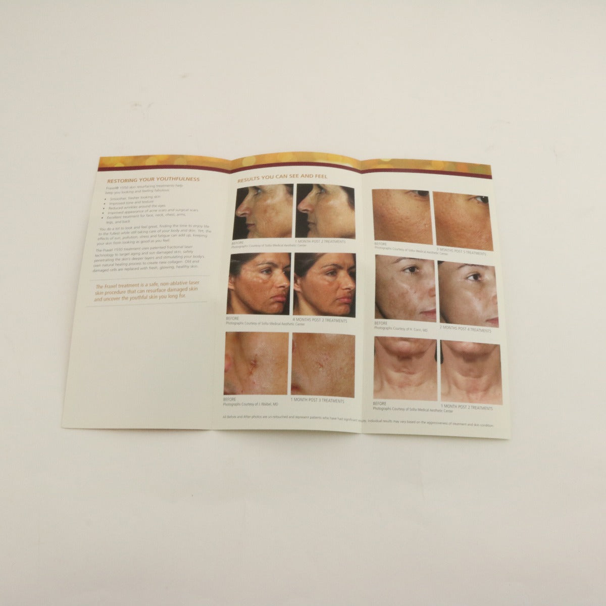 2011 Solta Fraxel Restore Dual 1550nm Skin Resurfacing Patient Brochures 33pk
