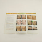 2011 Solta Fraxel Restore Dual 1550/1927 Skin Resurfacing Patient Brochures 25pk