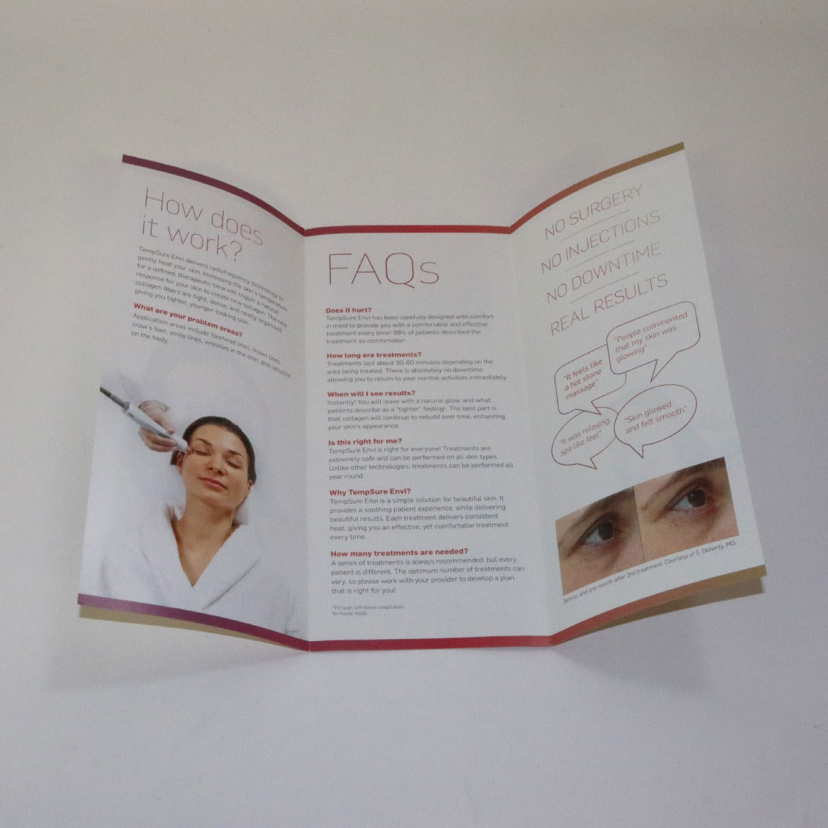2017 Cynosure TempSure Envi RF Skin Tightening Patient Brochures 23 Pack