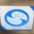 2008 Sciton BBLs Laser Broad Band Light Pigment HR Vascular ST IPL 275K SHOT BBL